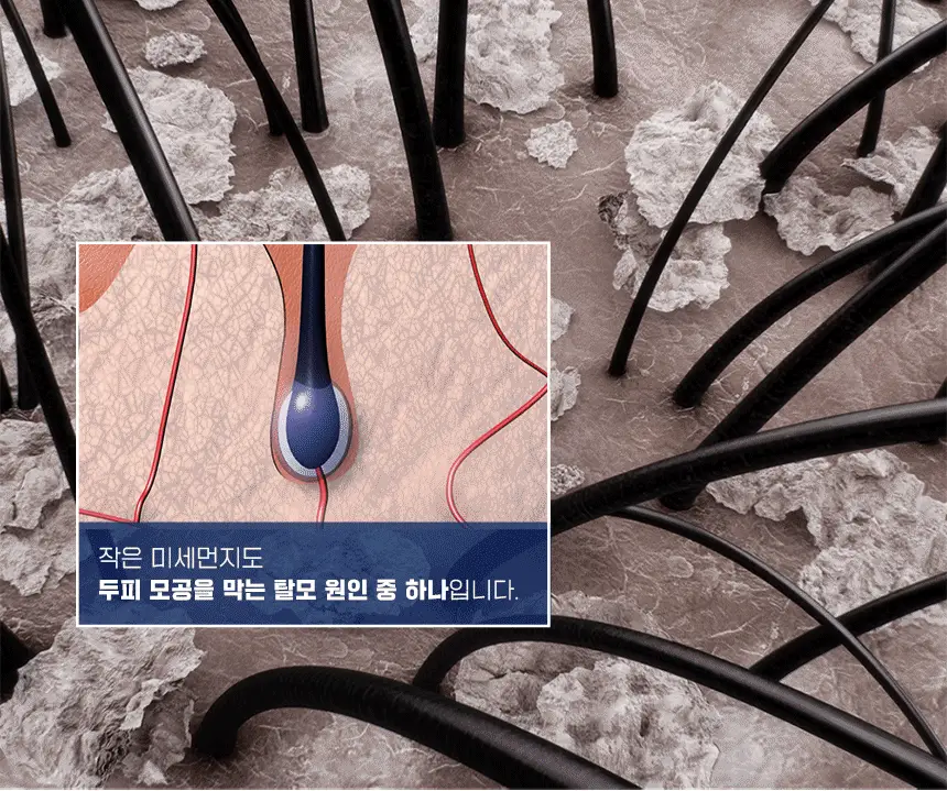 닥터방기원 랩 탈모샴푸 1000ml 더블 세트 상세페이지 9