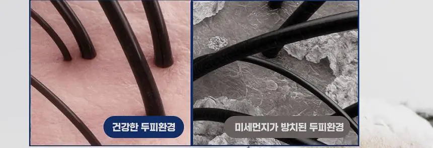 닥터방기원 랩 탈모샴푸 1000ml 더블 세트 상세페이지 15