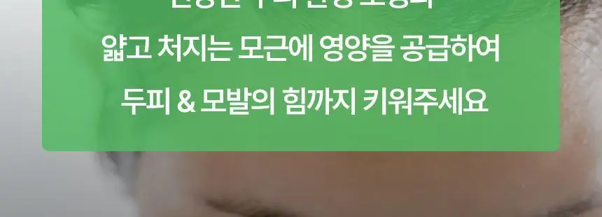 닥터방기원 어성초 민감두피 캡슐 탈모샴푸 740ml 상세페이지 5