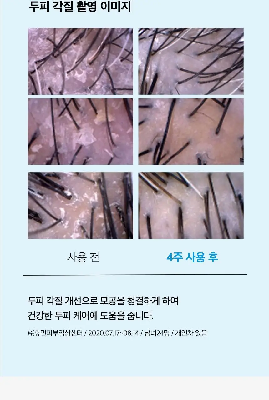 닥터방기원 쿨링 탈모샴푸 1000ml 상세페이지 19