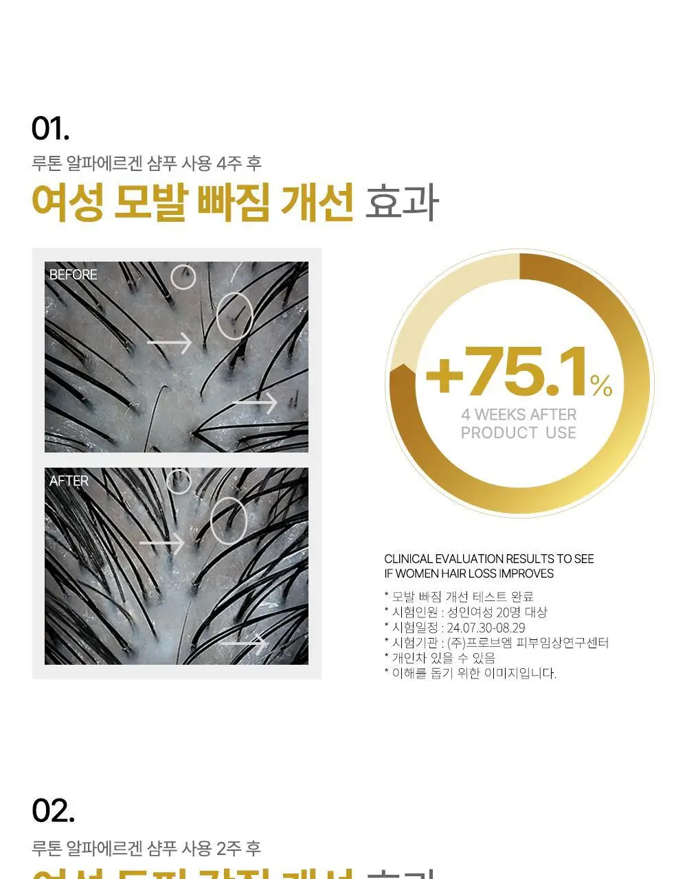 루톤 여성 두피용 알파에르겐 탈모샴푸 500ml+70ml 증정기획 상세페이지 7