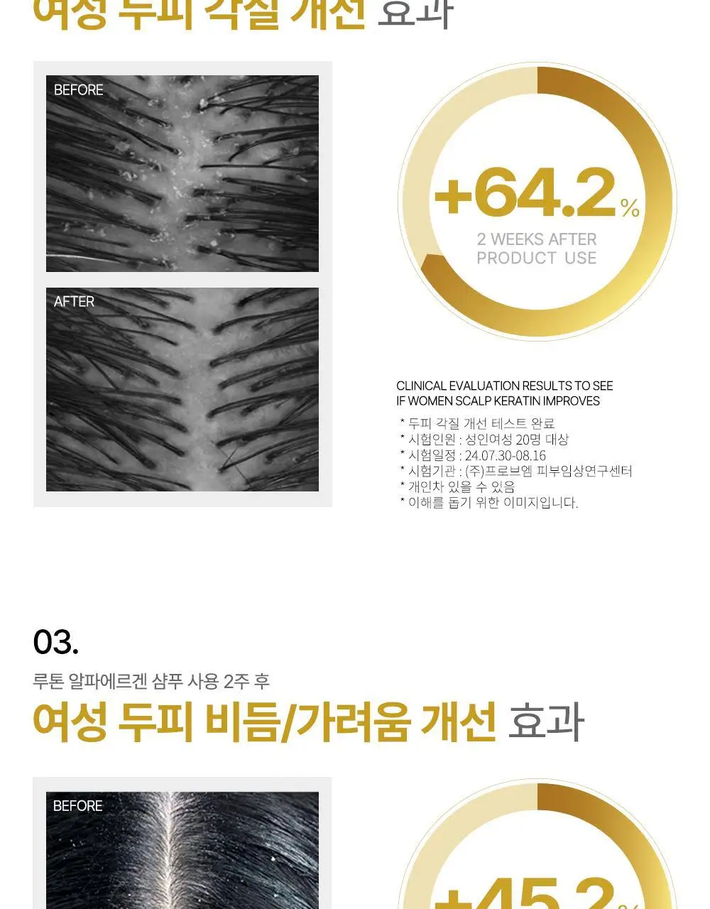 루톤 여성 두피용 알파에르겐 탈모샴푸 500ml+70ml 증정기획 상세페이지 8