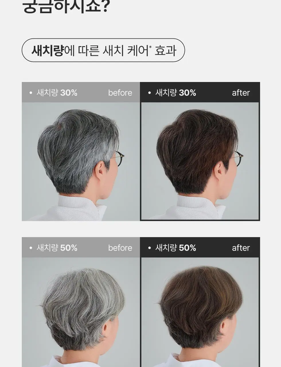 모다모다 제로그레이 블랙샴푸10 300g기획 (+10일 kit 증정) 상세페이지 19