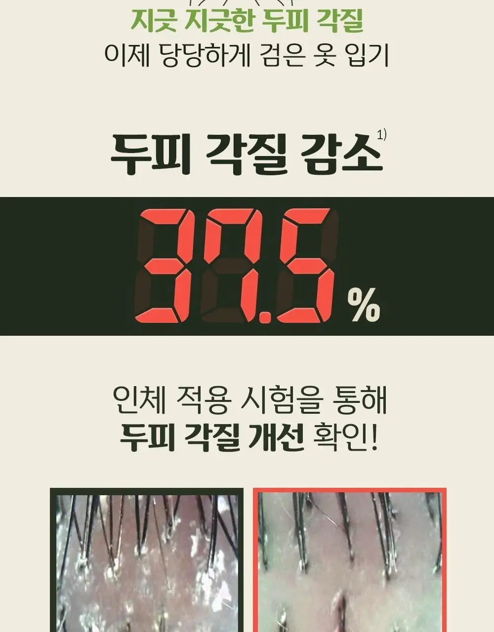 몽잘 바리스칼프 로즈마리샴푸 500ml 단품/기획 (탈모증상완화) 상세페이지 22