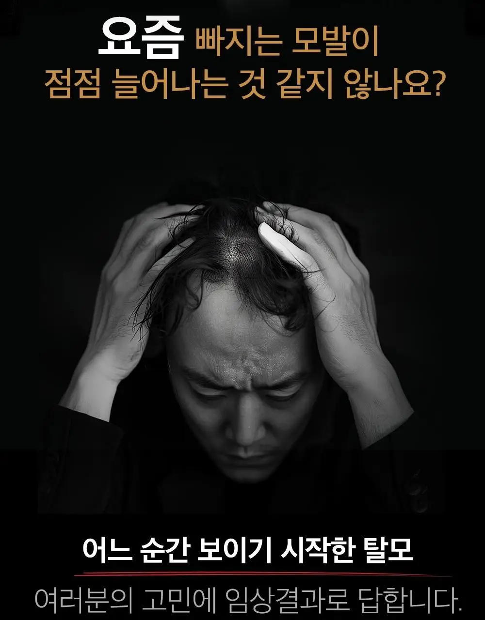 몽잘 바리스칼프 커피샴푸 500ml 단품/기획 (탈모증상완화) 상세페이지 4