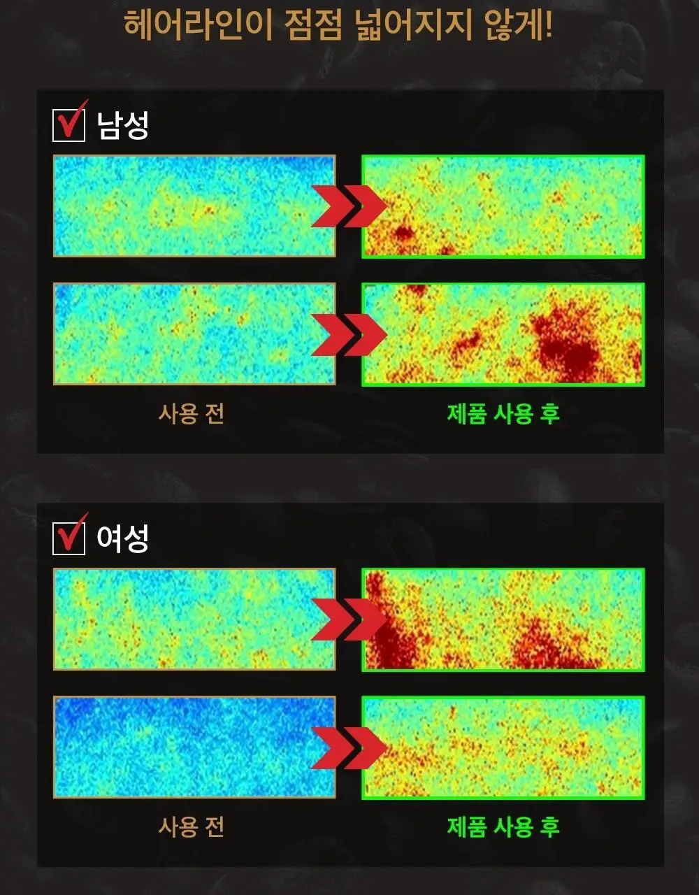 몽잘 바리스칼프 커피샴푸 500ml 단품/기획 (탈모증상완화) 상세페이지 25