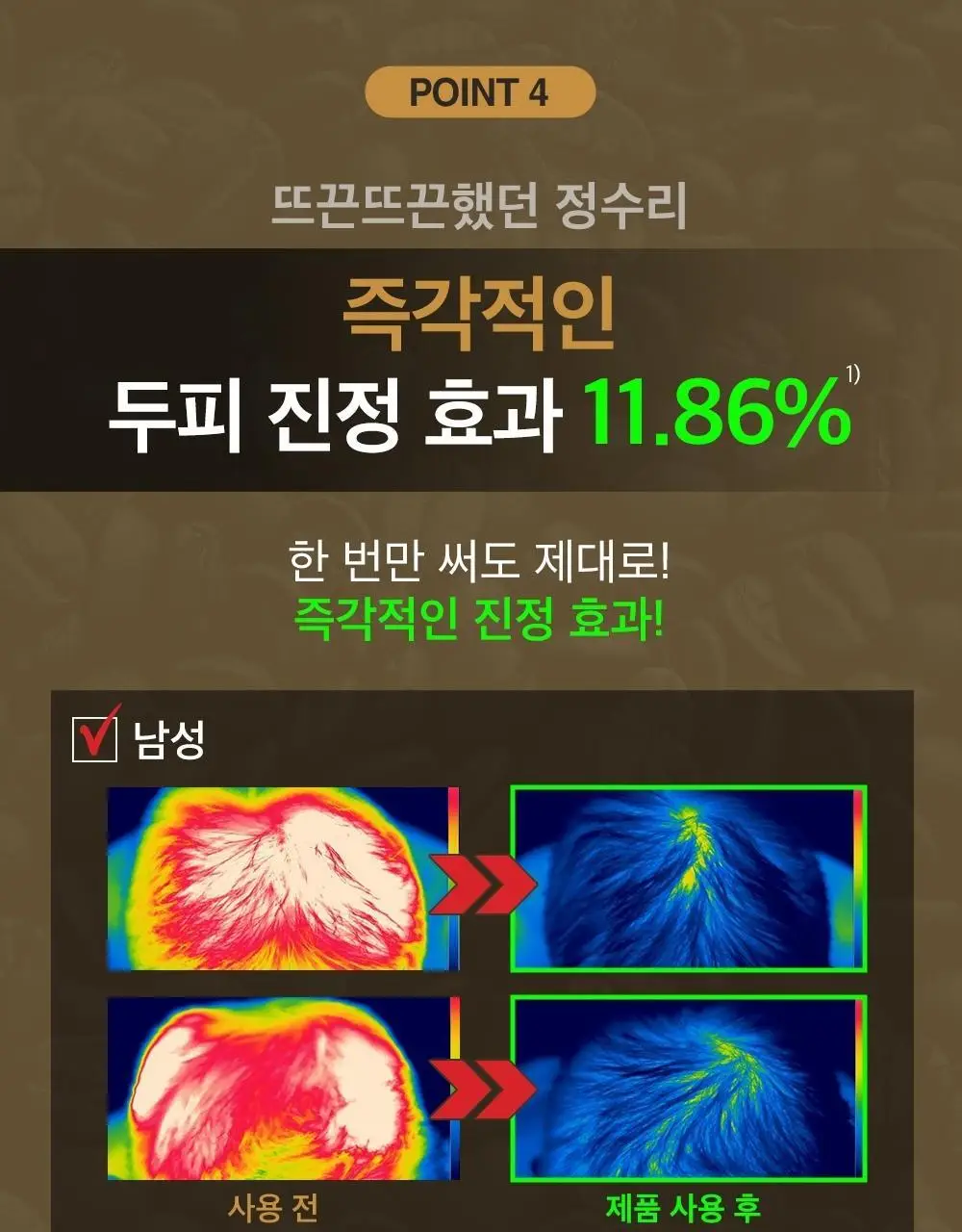 몽잘 바리스칼프 커피샴푸 500ml 단품/기획 (탈모증상완화) 상세페이지 27