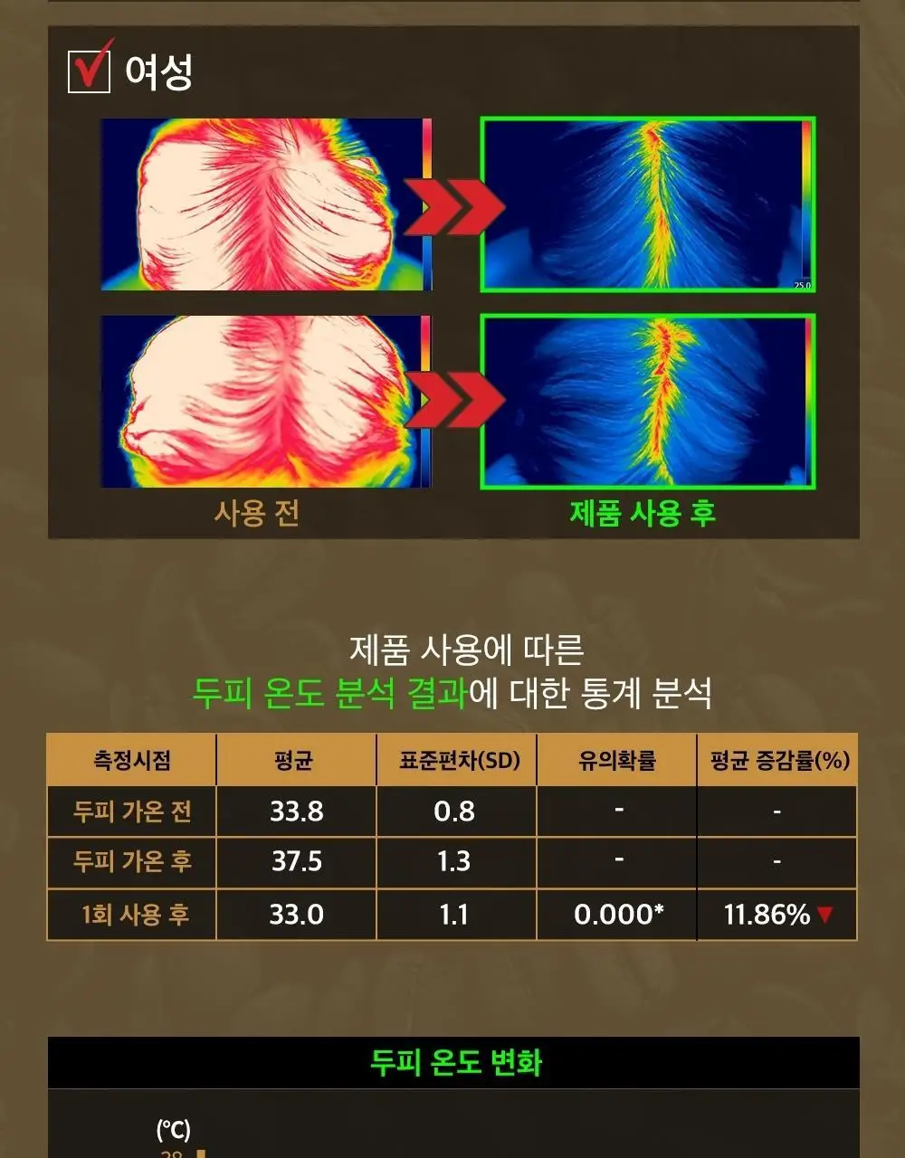몽잘 바리스칼프 커피샴푸 500ml 단품/기획 (탈모증상완화) 상세페이지 28