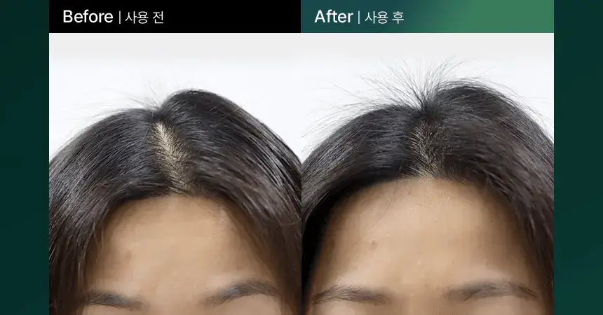 바이브랩 리바이 솔루션 안티 헤어 로스 스칼프 샴푸 300ml 상세페이지 26