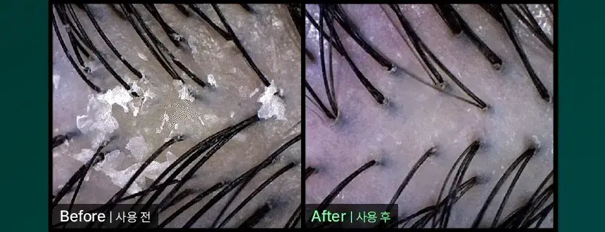 바이브랩 리바이 솔루션 안티 헤어 로스 스칼프 샴푸 300ml 상세페이지 33