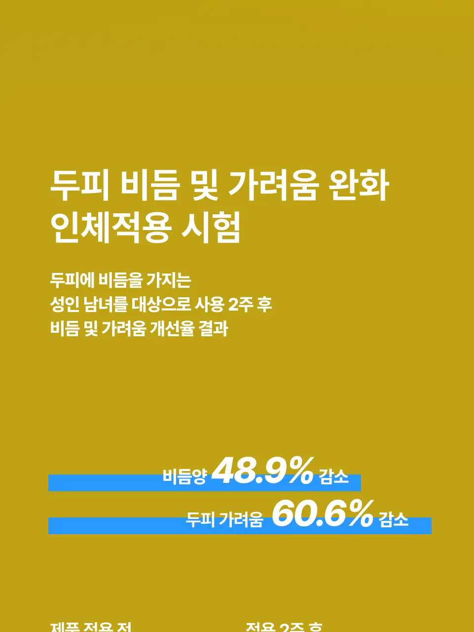 반코르 비듬개선 덱스판테놀 샴푸 500ml 상세페이지 2