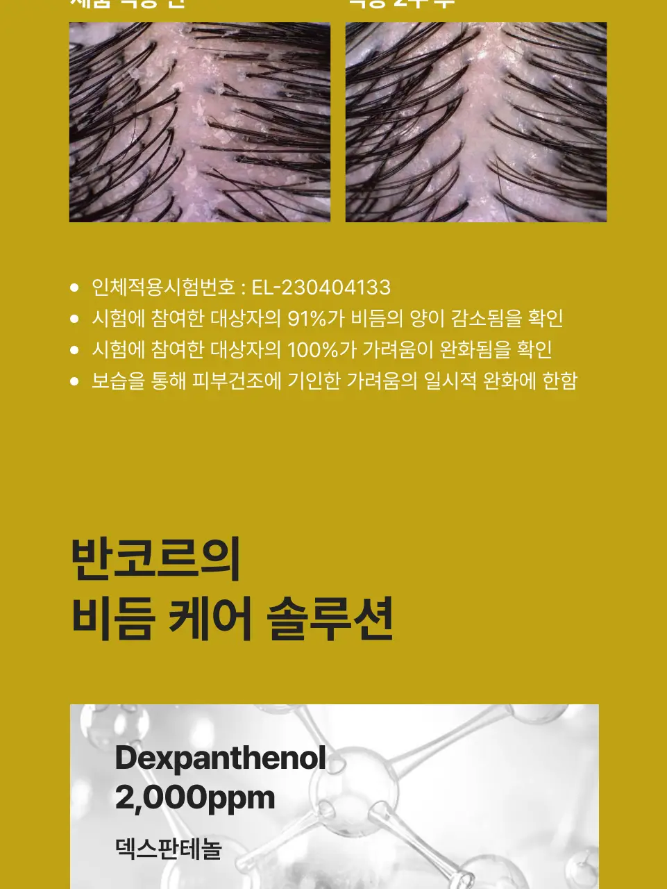 반코르 비듬개선 덱스판테놀 샴푸 500ml 상세페이지 3