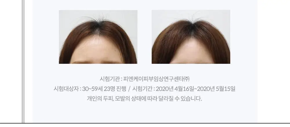 보타믹스 포레스트 그로우 인텐시브 샴푸 500ml(탈모증상완화) 상세페이지 13