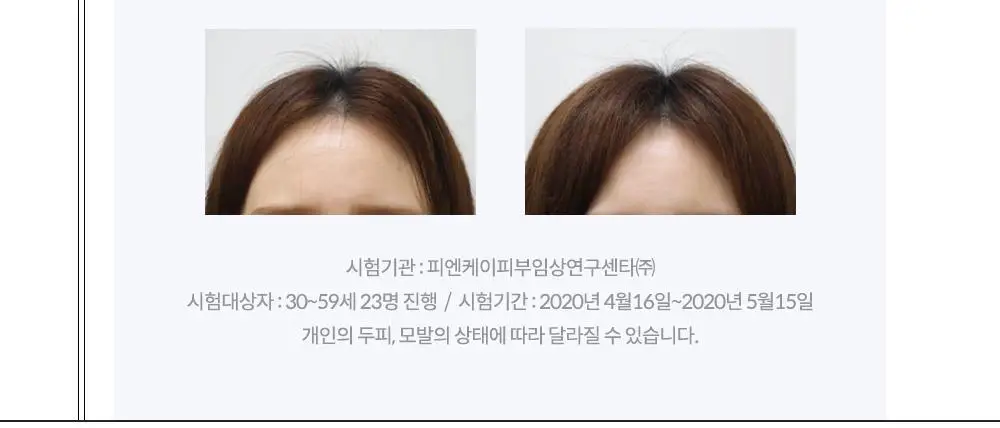 보타믹스 포레스트 그로우 인텐시브 샴푸, 트리트먼트 2종중 택1(탈모증상완화) 상세페이지 14