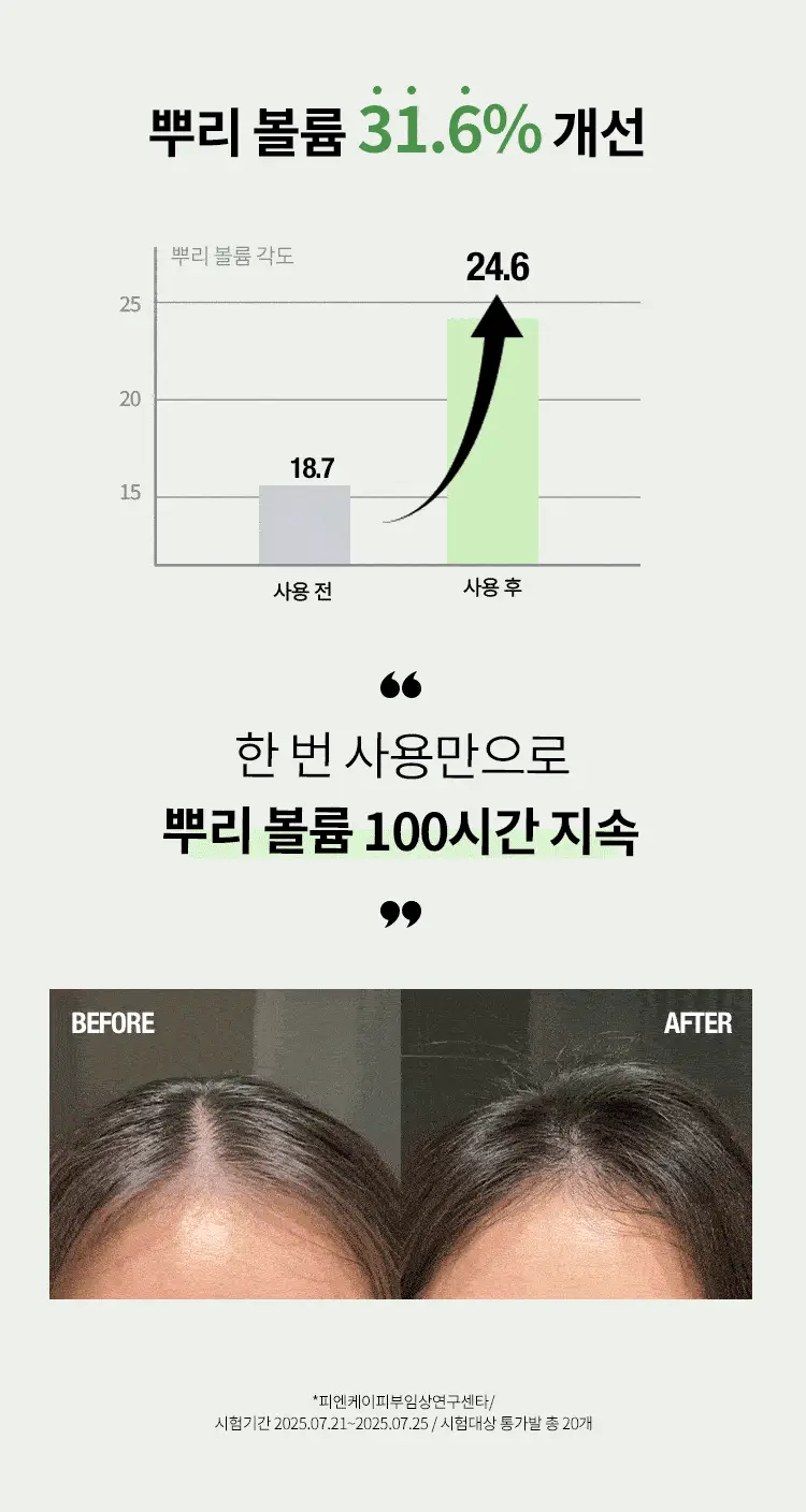 아이엠 샴푸 인텐시브 스칼프 케어 (480ml/700ml) 상세페이지 3