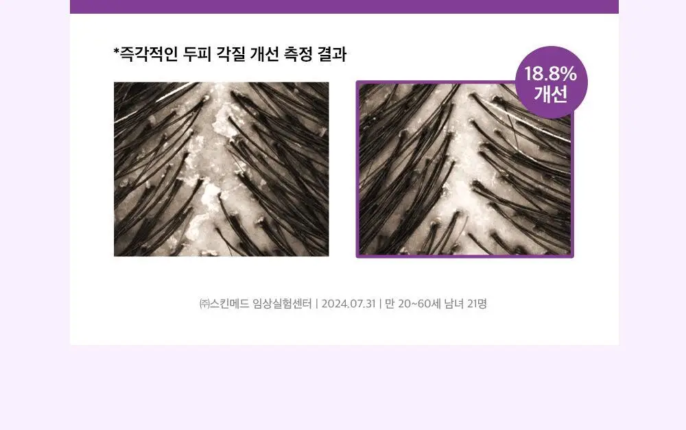 얼라이브랩 오투 스칼프 워터 샴푸 350ml 상세페이지 7