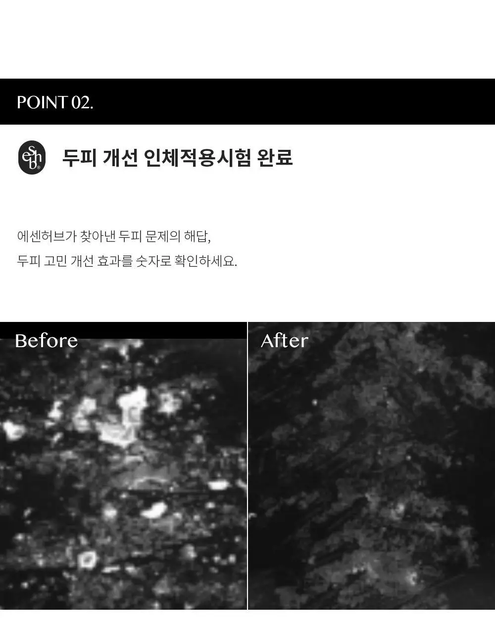 에센허브 티트리 딥클린 스칼프 샴푸 500ml 상세페이지 6
