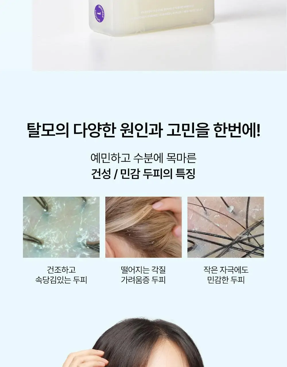 위드비컨 탈모증상완화 기브미워터 샴푸 360ml(건성/민감성 두피) 상세페이지 9