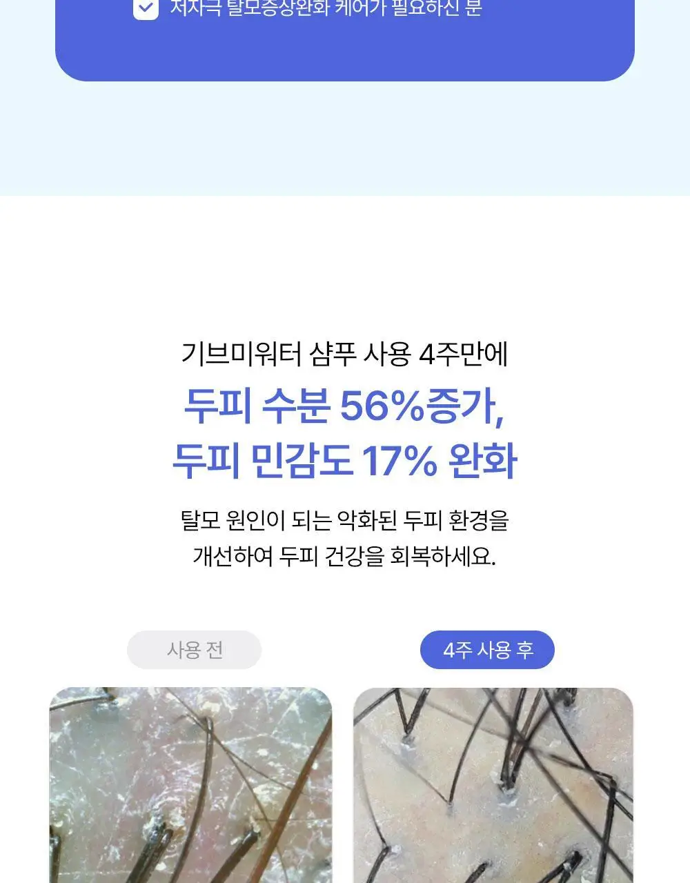 위드비컨 탈모증상완화 기브미워터 샴푸 360ml(건성/민감성 두피) 상세페이지 11
