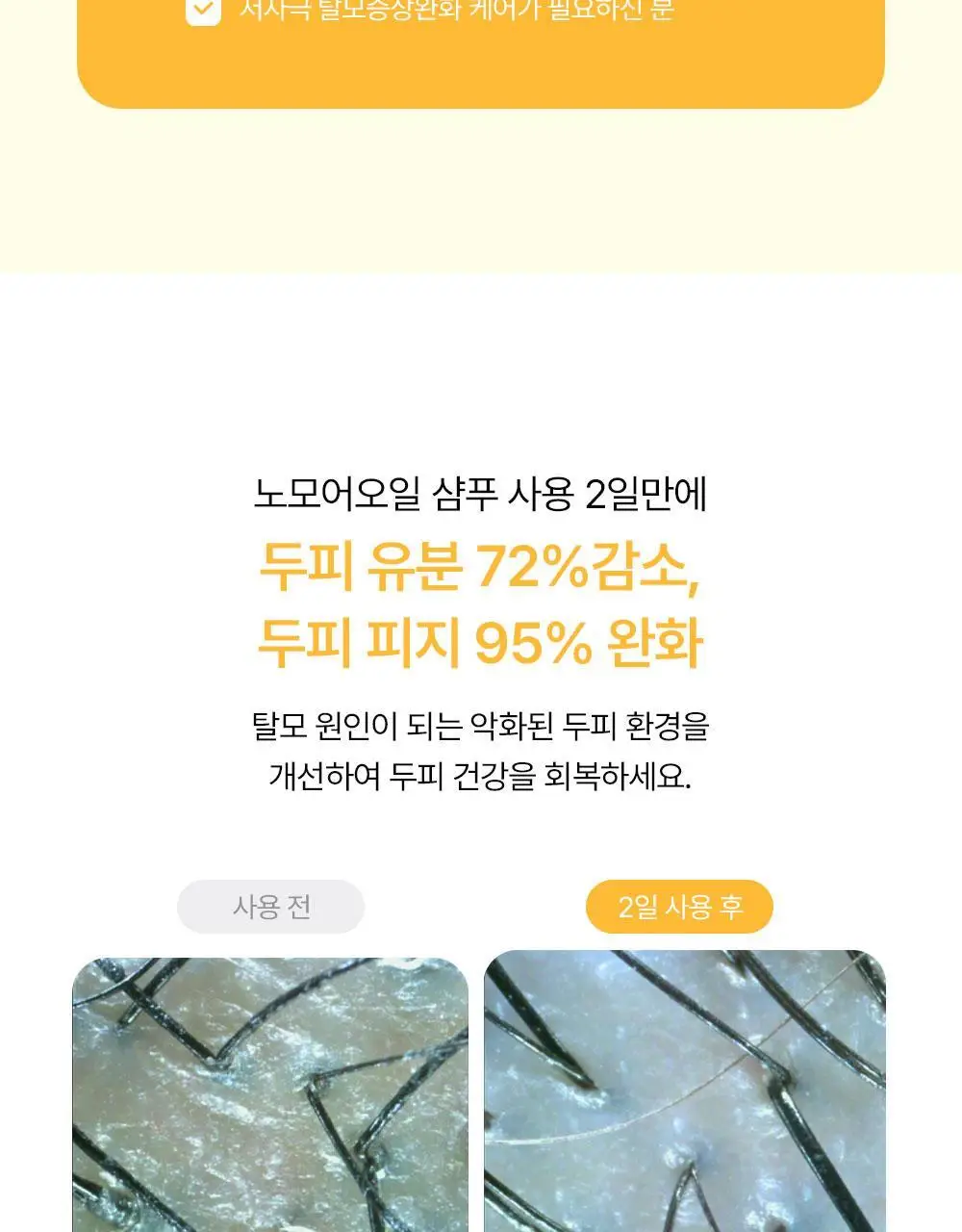위드비컨 탈모증상완화 노모어오일 샴푸 360ml(지성 두피) 상세페이지 11