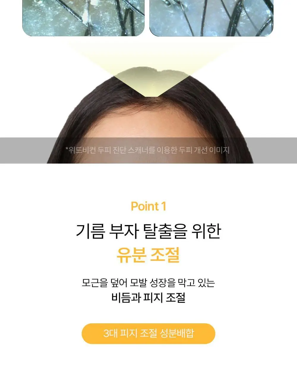 위드비컨 탈모증상완화 노모어오일 샴푸 360ml(지성 두피) 상세페이지 12