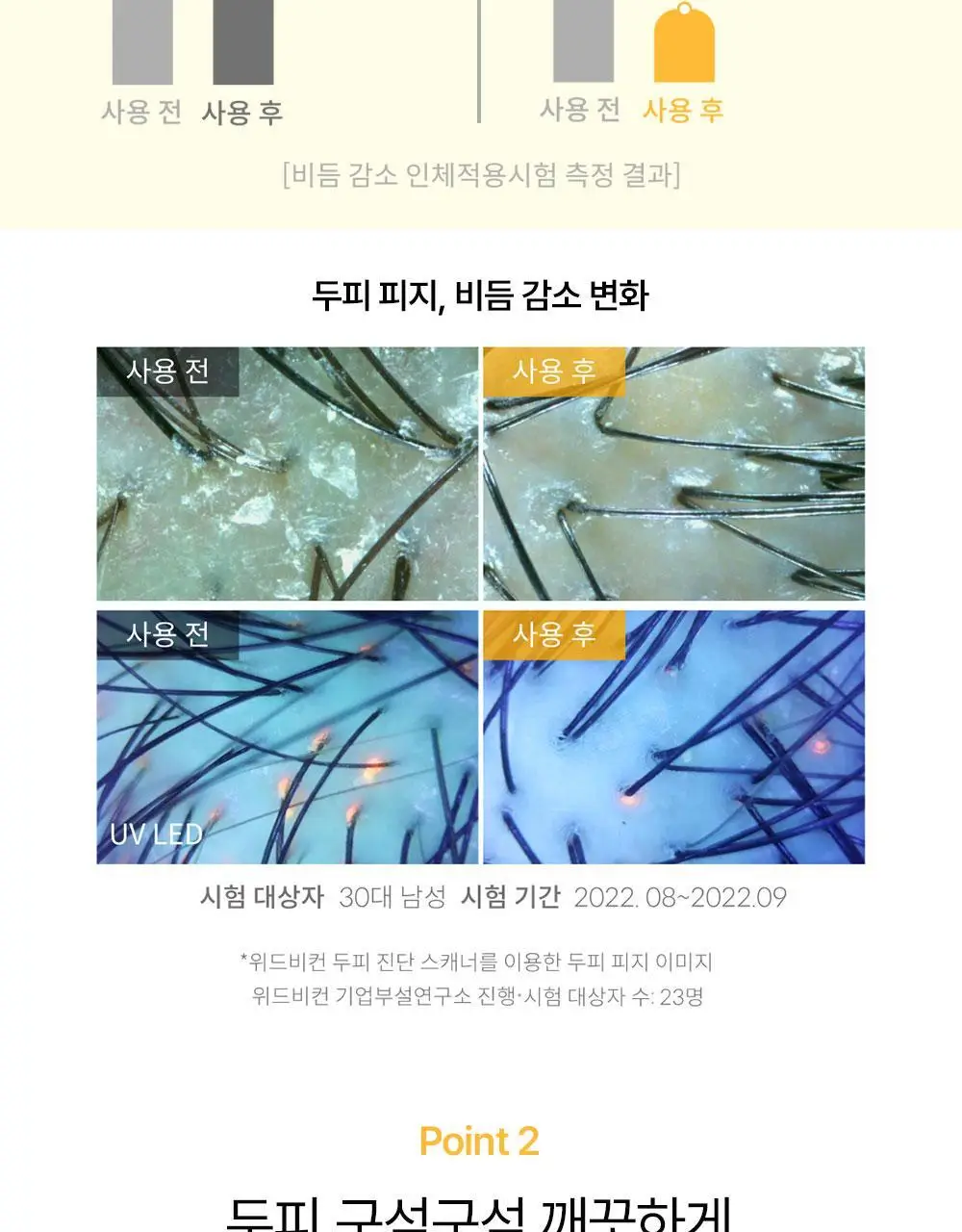 위드비컨 탈모증상완화 노모어오일 샴푸 360ml(지성 두피) 상세페이지 14