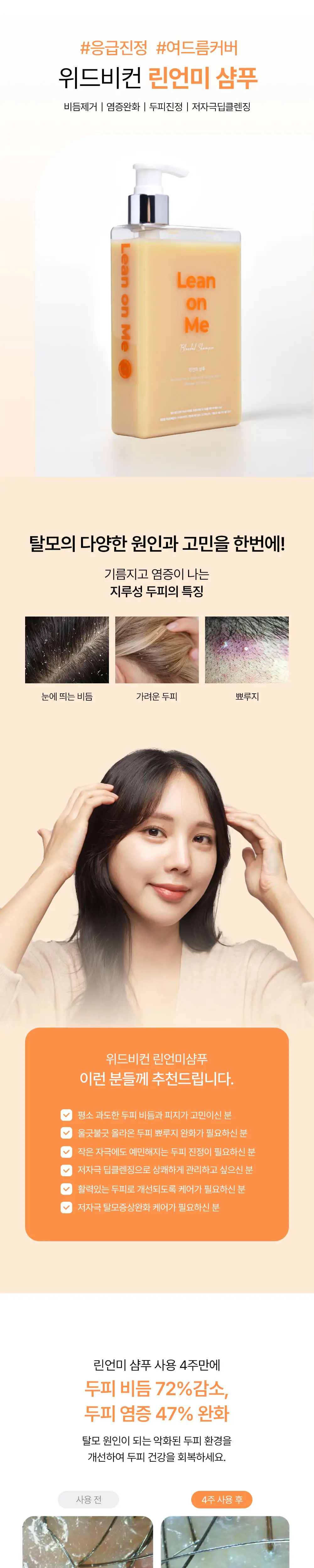 위드비컨 탈모증상완화 린언미 샴푸 360ml(지루성 두피) 상세페이지 2