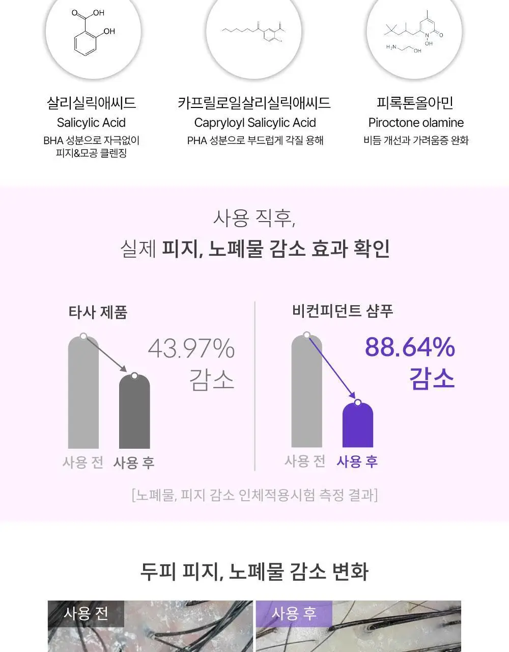 위드비컨 탈모증상완화 비컨피던트 샴푸 360ml(복합성 두피) 상세페이지 13