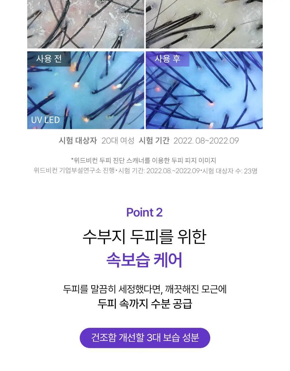 위드비컨 탈모증상완화 비컨피던트 샴푸 360ml(복합성 두피) 상세페이지 14