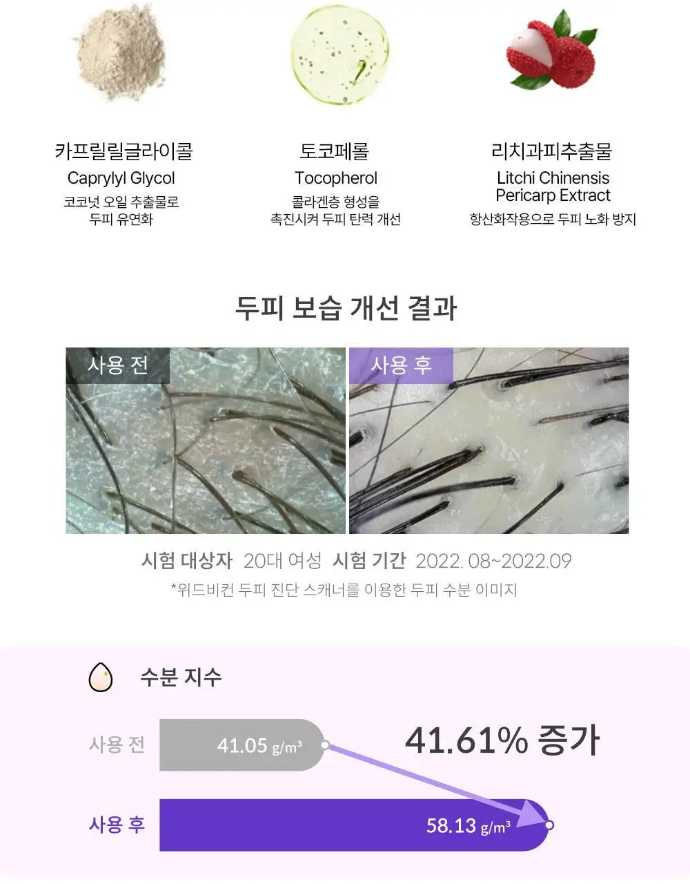 위드비컨 탈모증상완화 비컨피던트 샴푸 360ml(복합성 두피) 상세페이지 15