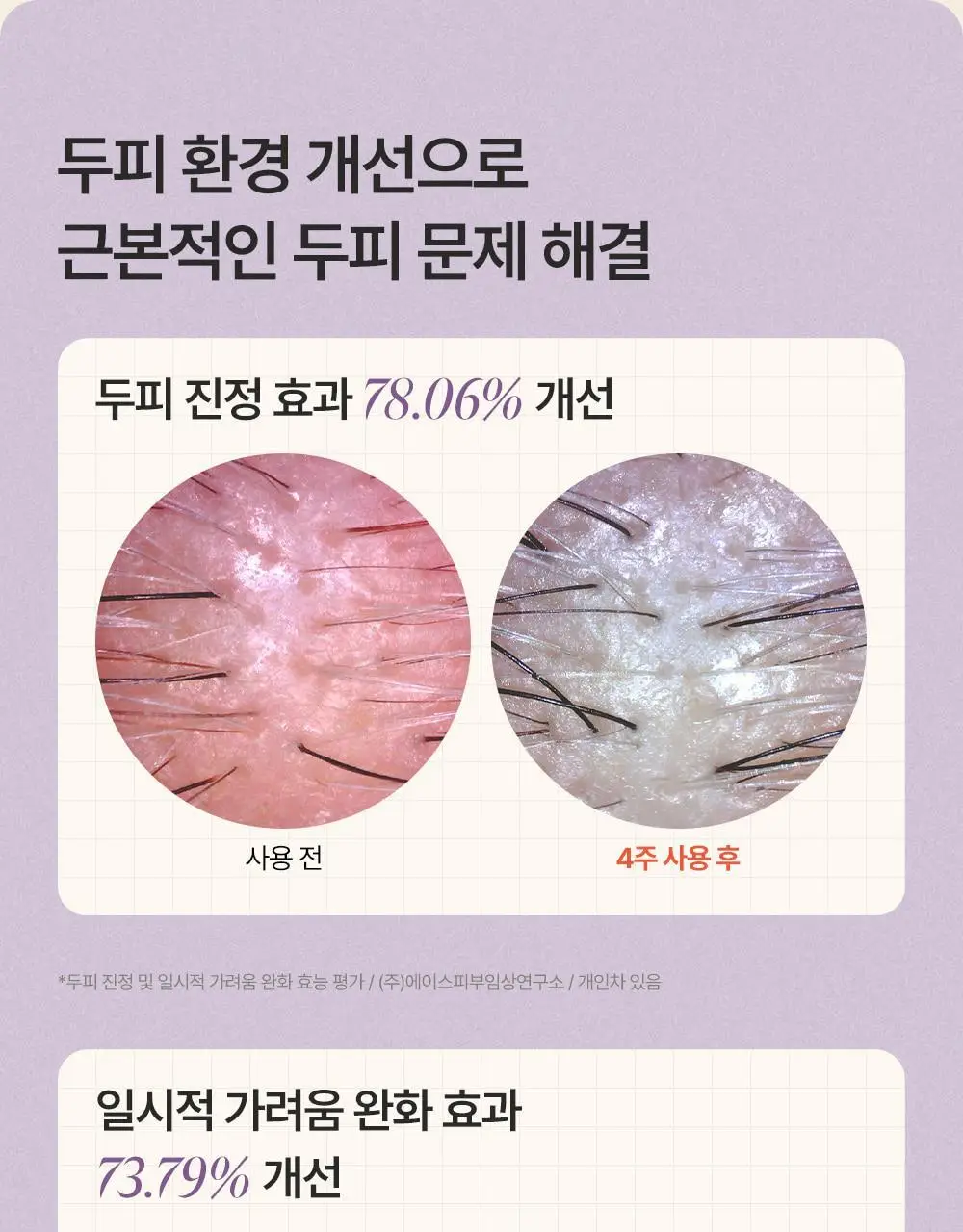 트리코닉스 트리코엑스 탈모완화 볼륨 샴푸 500ml 상세페이지 46
