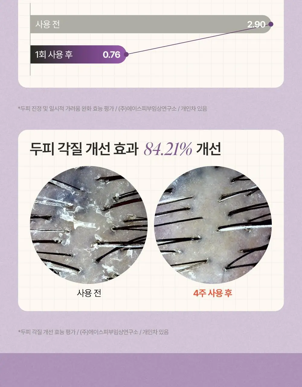 트리코닉스 트리코엑스 탈모완화 볼륨 샴푸 500ml 상세페이지 47