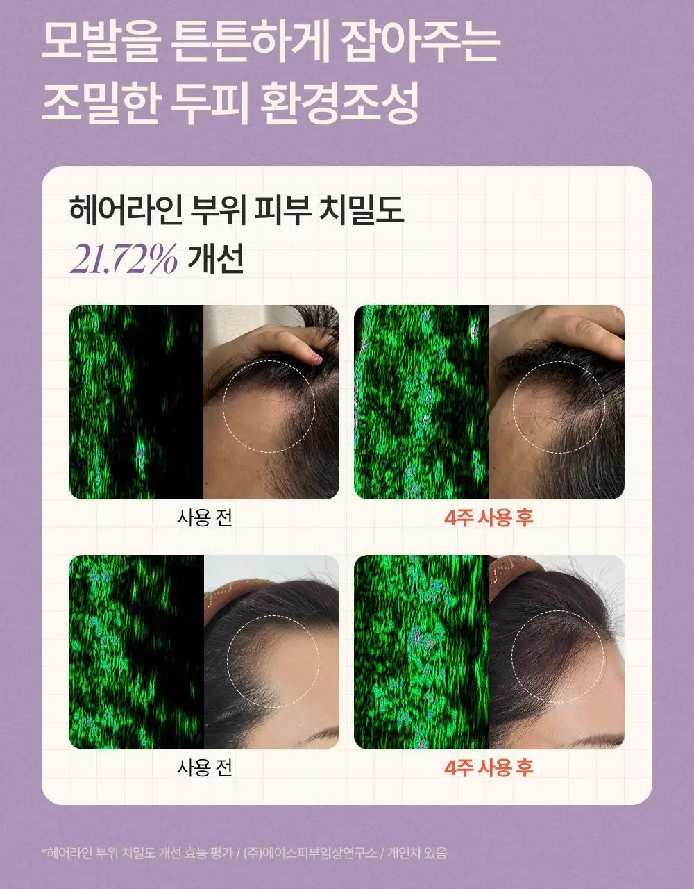 트리코닉스 트리코엑스 탈모완화 볼륨 샴푸 500ml 상세페이지 48