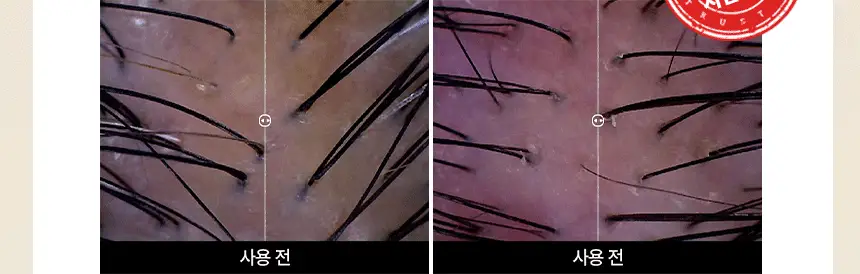 TS 어성초 카밍 샴푸 500g (+6g*3ea) 상세페이지 16