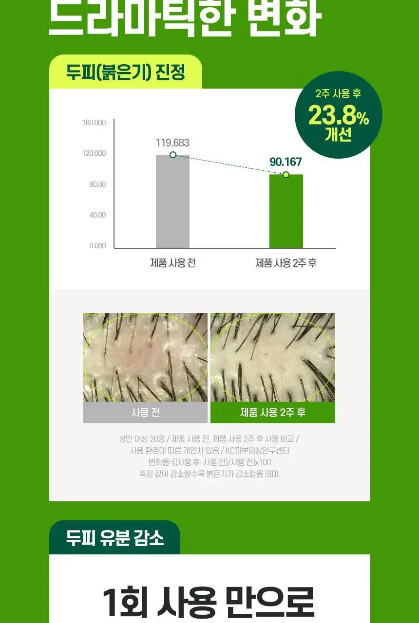 TS BD샴푸 500g 상세페이지 6
