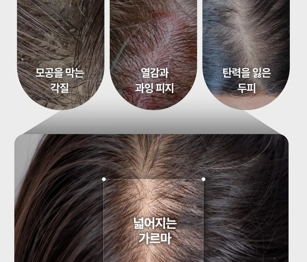 VT 리들샷 헤어 부스팅 스케일링 샴푸 500ml 상세페이지 12