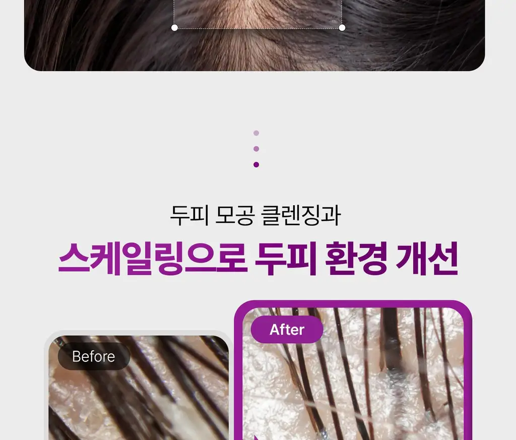 VT 리들샷 헤어 부스팅 스케일링 샴푸 500ml 상세페이지 13