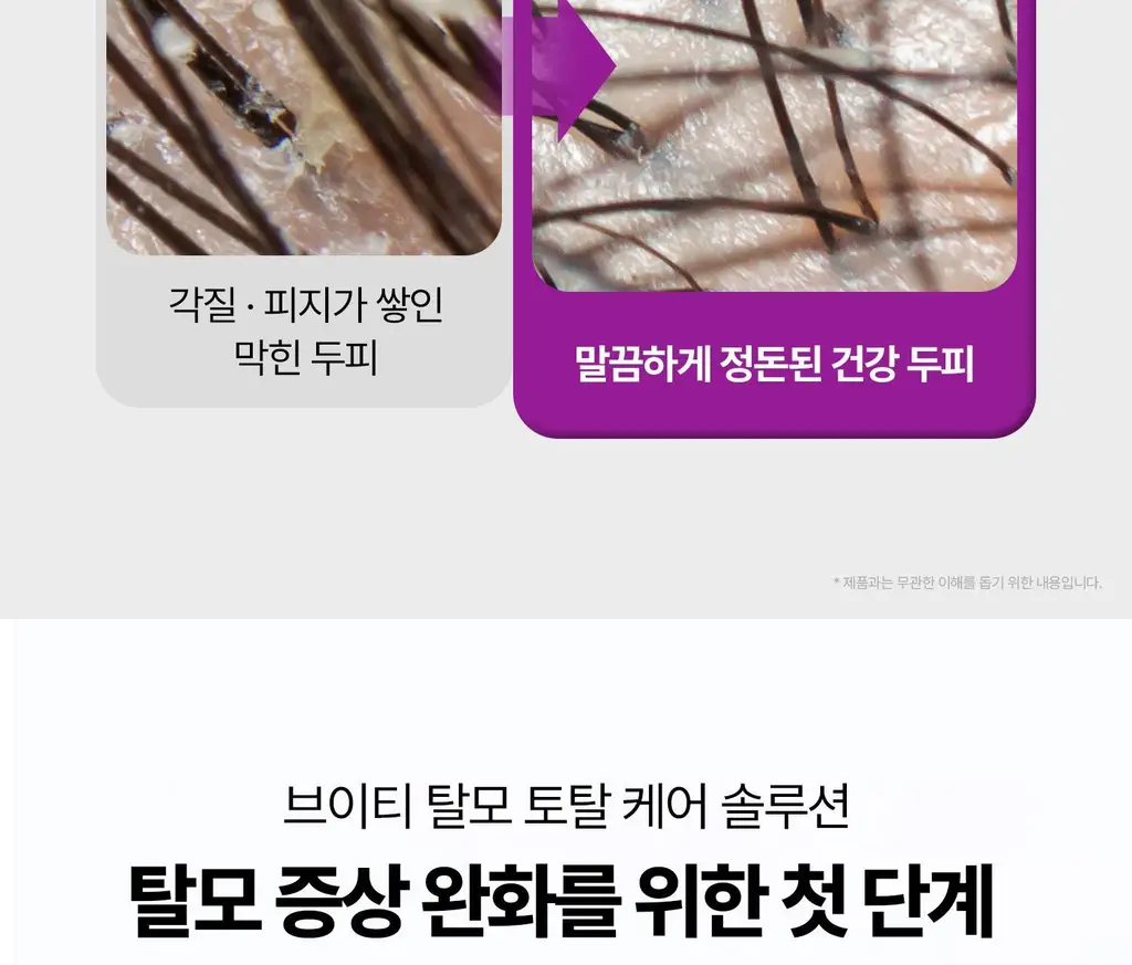 VT 리들샷 헤어 부스팅 스케일링 샴푸 500ml 상세페이지 14