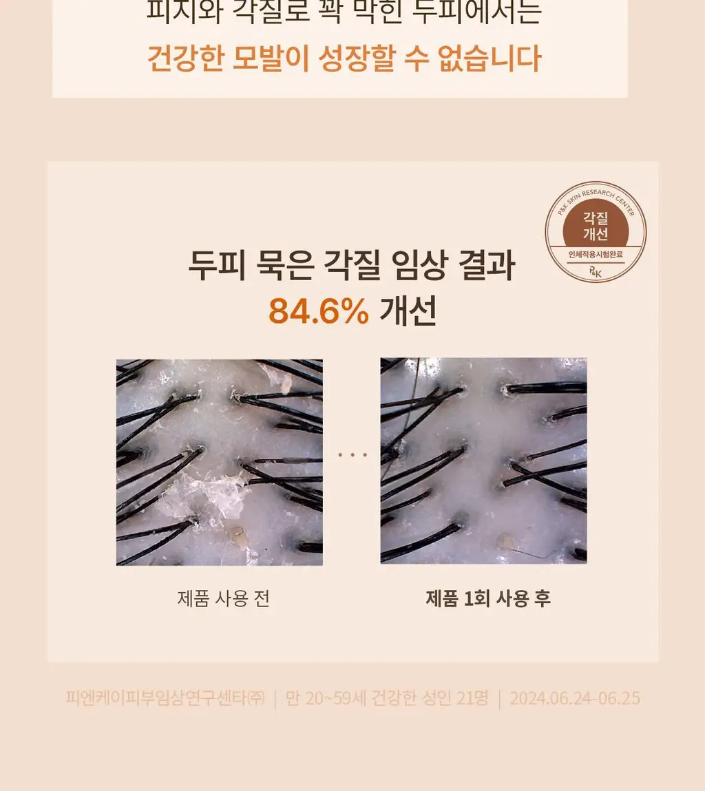 스팀베이스 터메릭 스칼프 워터 스케일러 250ml 상세페이지 7