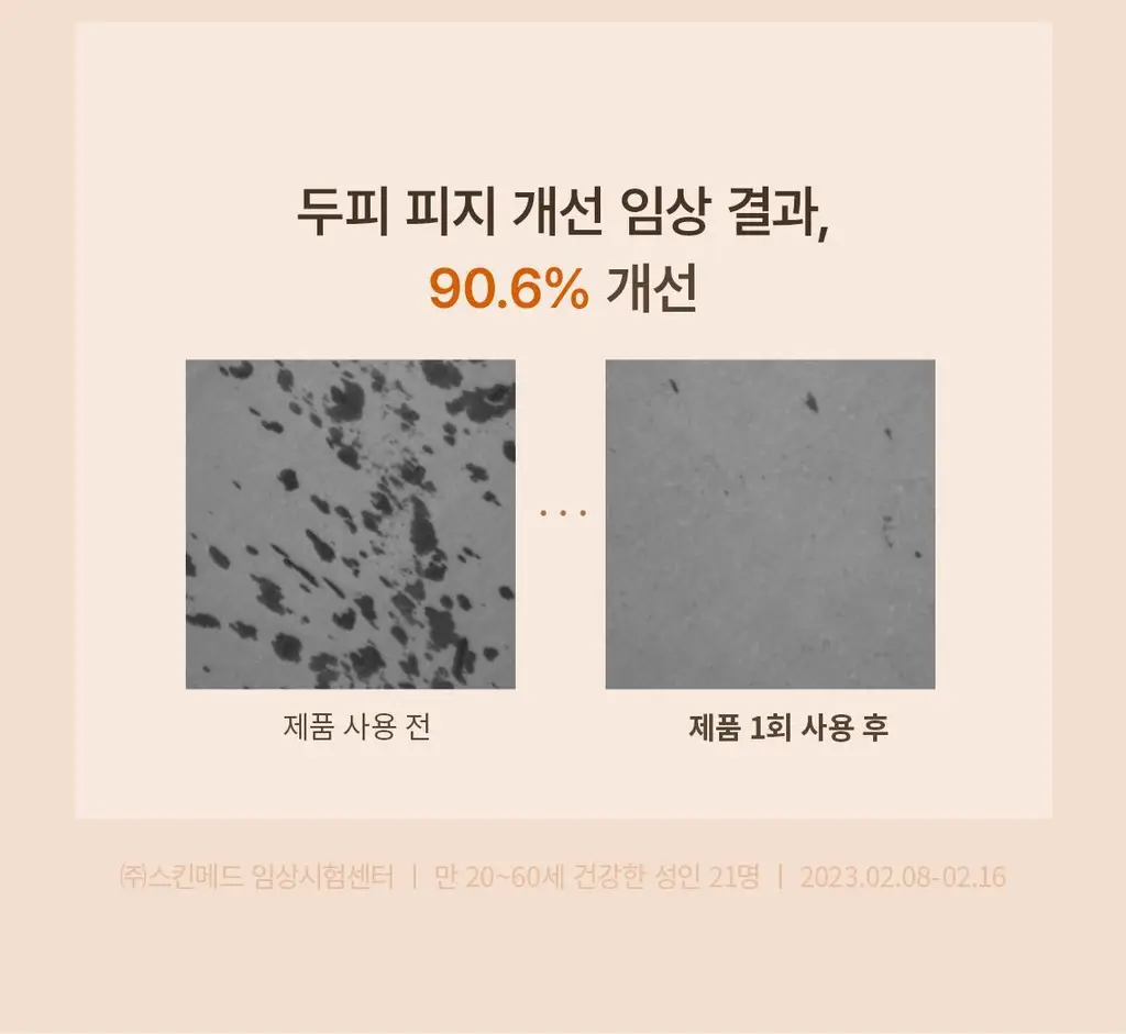 스팀베이스 터메릭 스칼프 워터 스케일러 250ml 상세페이지 8