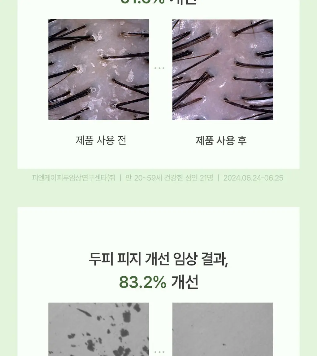 스팀베이스 티트리 스칼프 워터 스케일러 250ml 기획세트(+50ml+브러쉬 증정) 상세페이지 7
