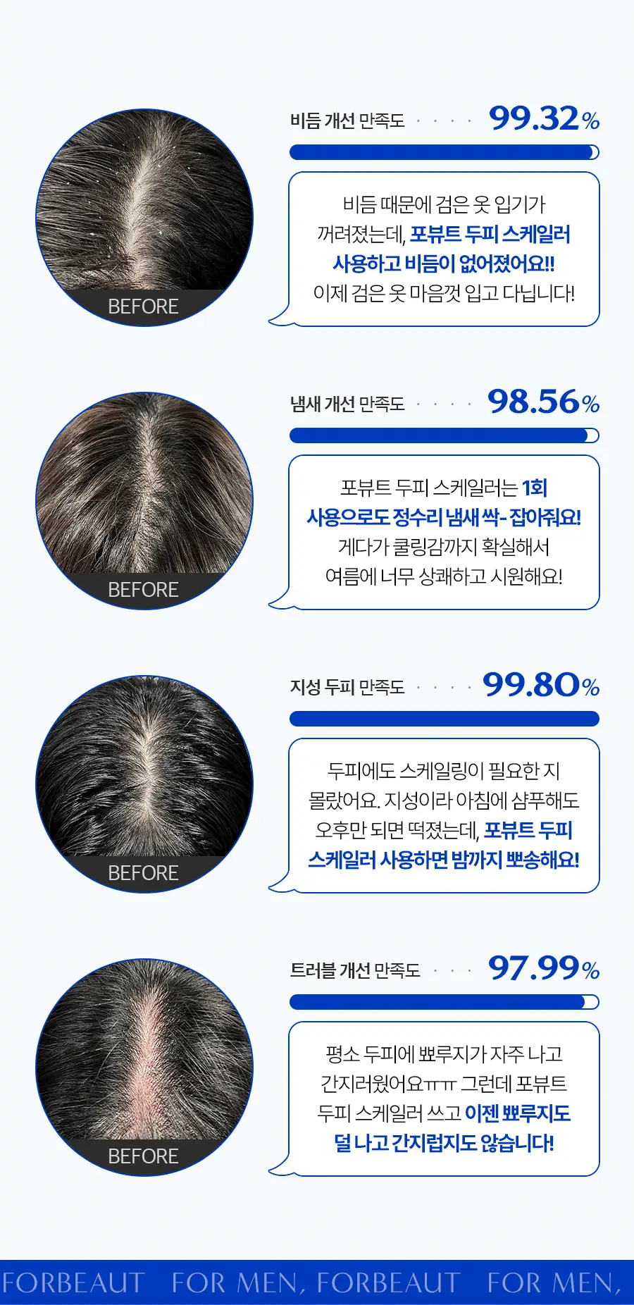 포뷰트 하이퍼 딥클렌징 두피 스케일러 15g(4개입) 상세페이지 7