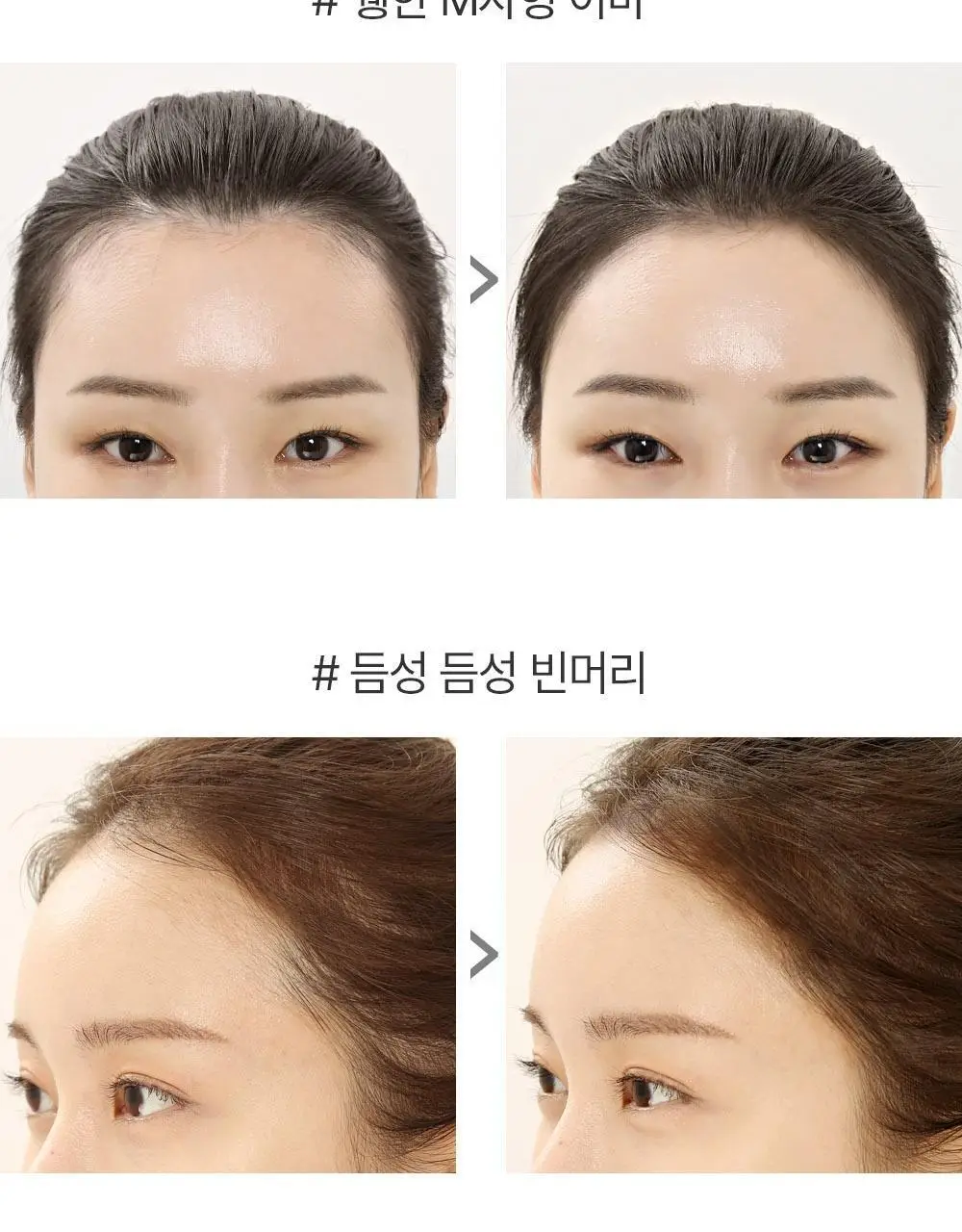 쏘내추럴 헤어 라인 커버 쿠션 상세페이지 8