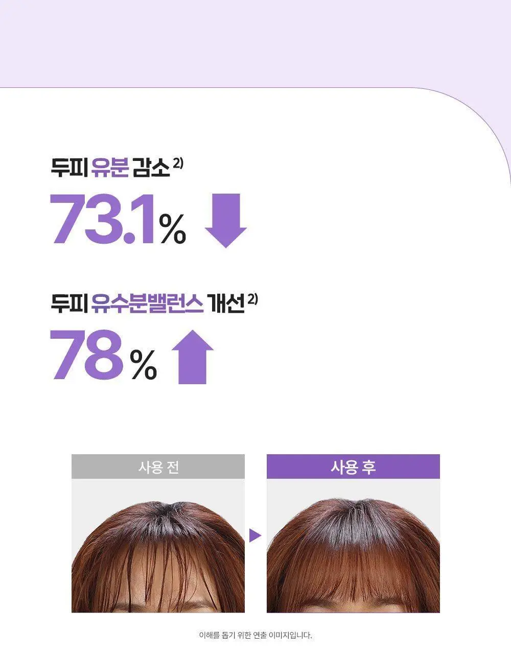 닥터그루트 아쿠아 캡슐 트리트먼트 200ml 한정 기획 (+뿌리볼륨집게 증정) 상세페이지 9