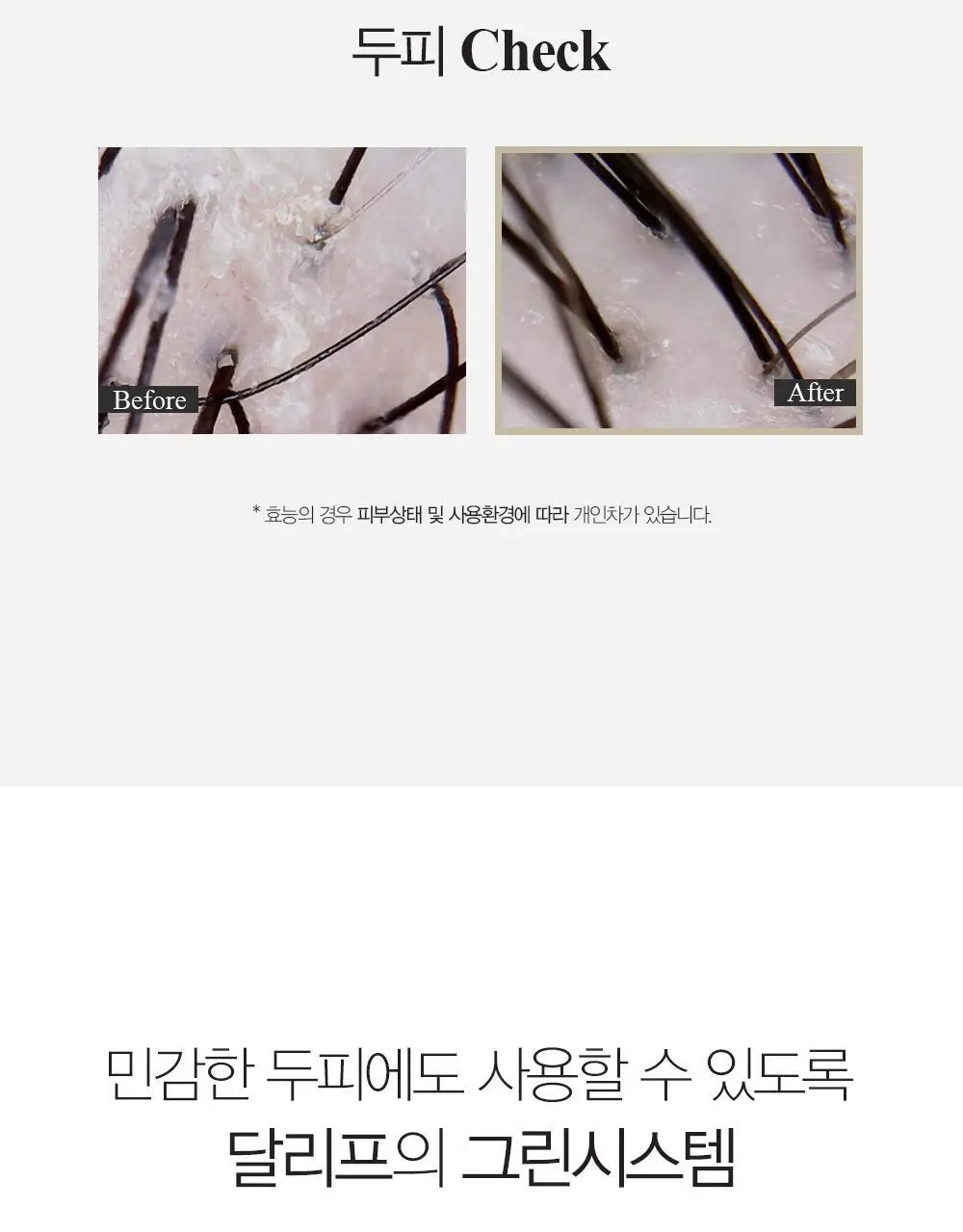 달리프 애플민트 쿨링 스케일러 250g (탈모증상완화/두피노폐물흡착) 상세페이지 28