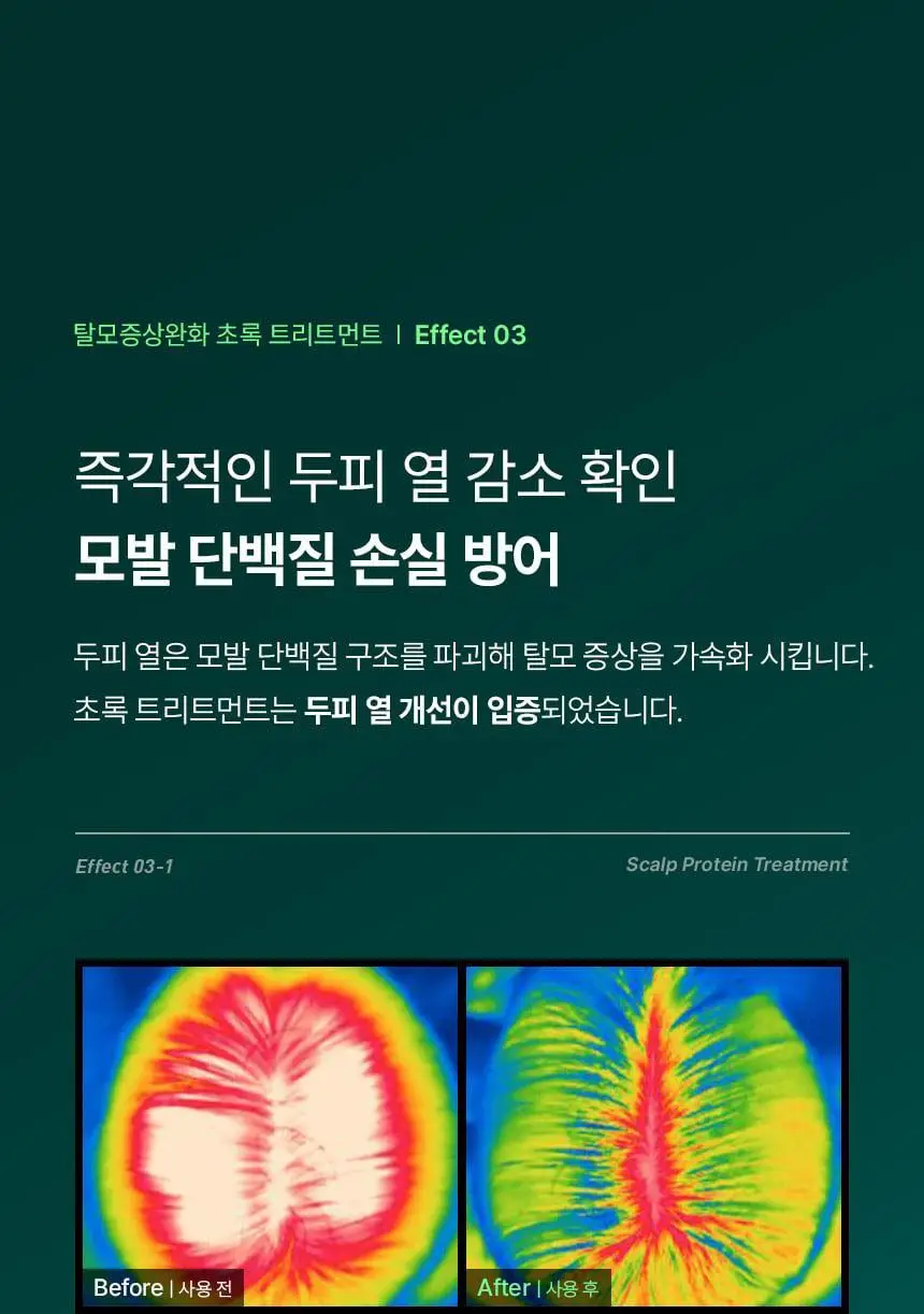 바이브랩 리바이 솔루션 스칼프 프로틴 트리트먼트 200ml 더블기획 상세페이지 21