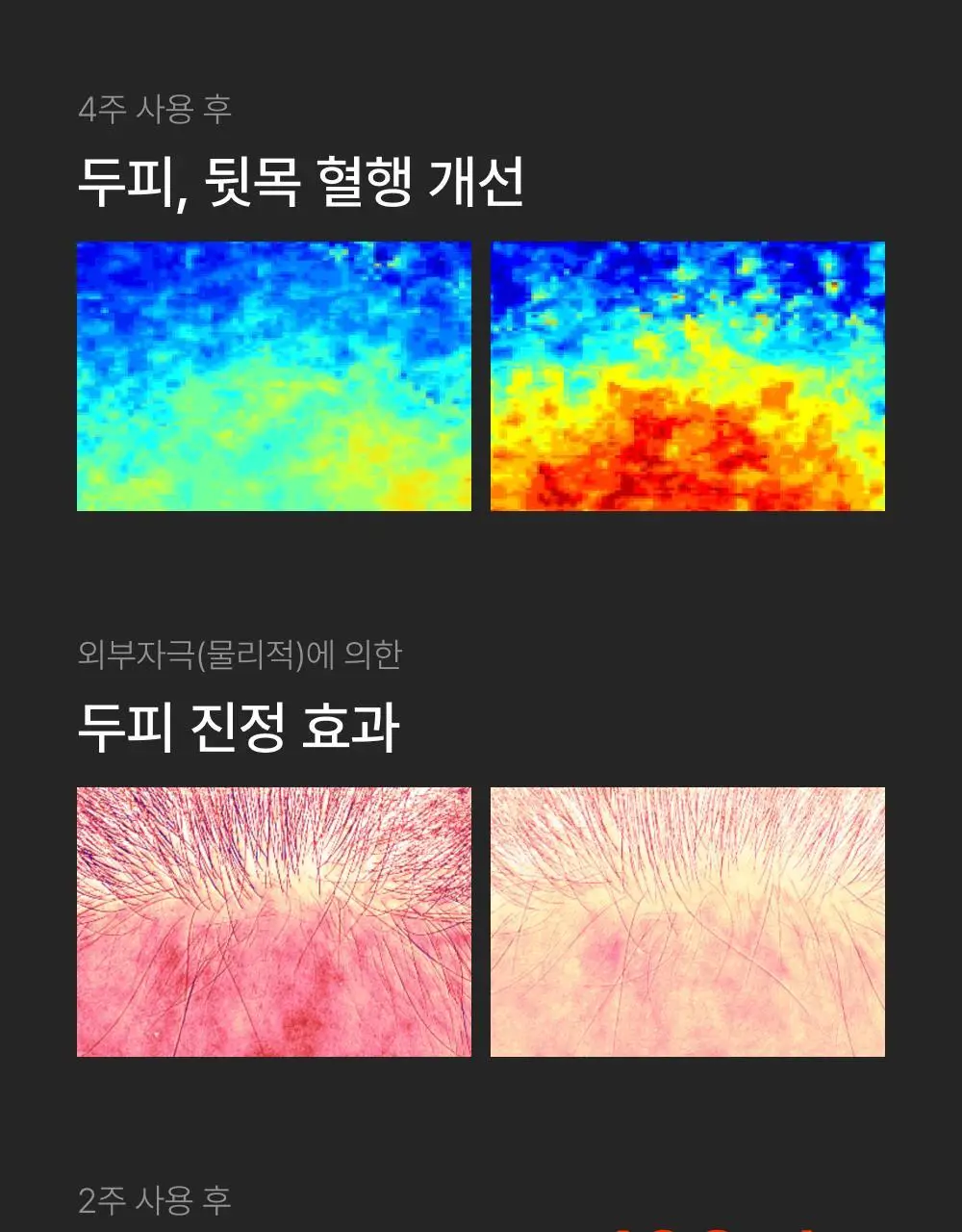 릴리이브 그로우턴 브러쉬 스팀 부스터 상세페이지 55