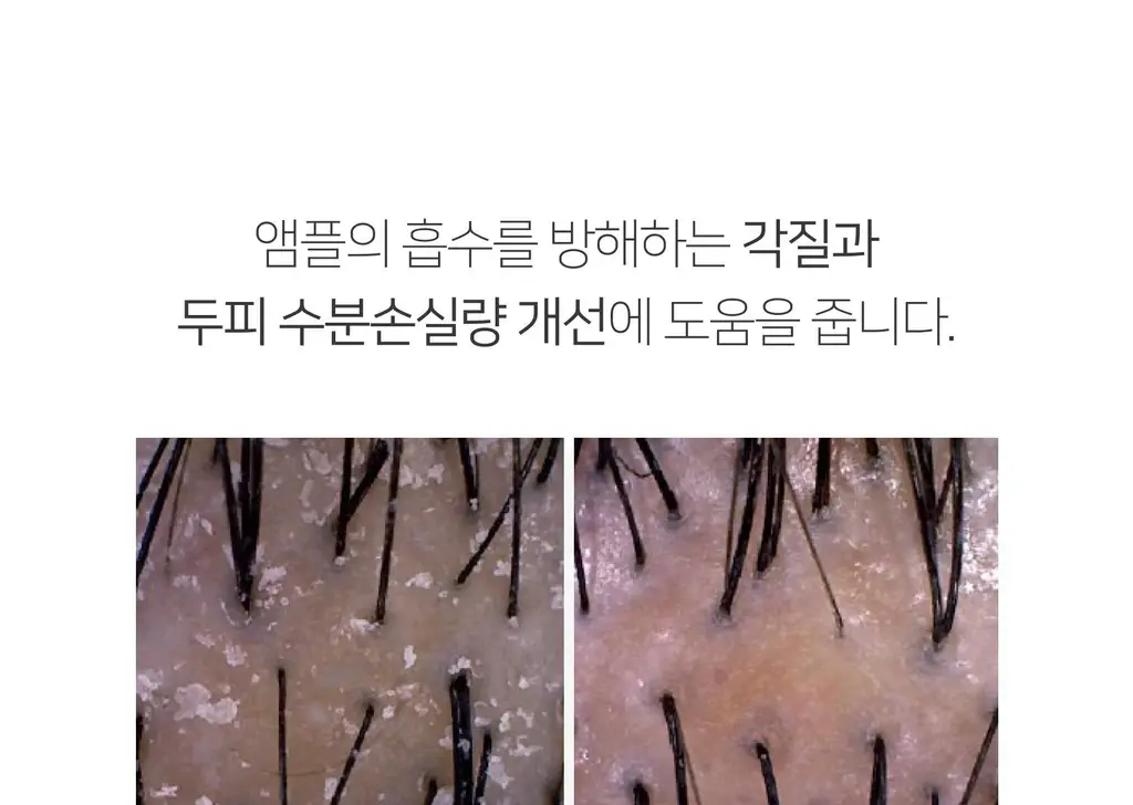 무아스 3 in 1 EMS 두피 케어 마사지기 뷰티디바이스 상세페이지 55
