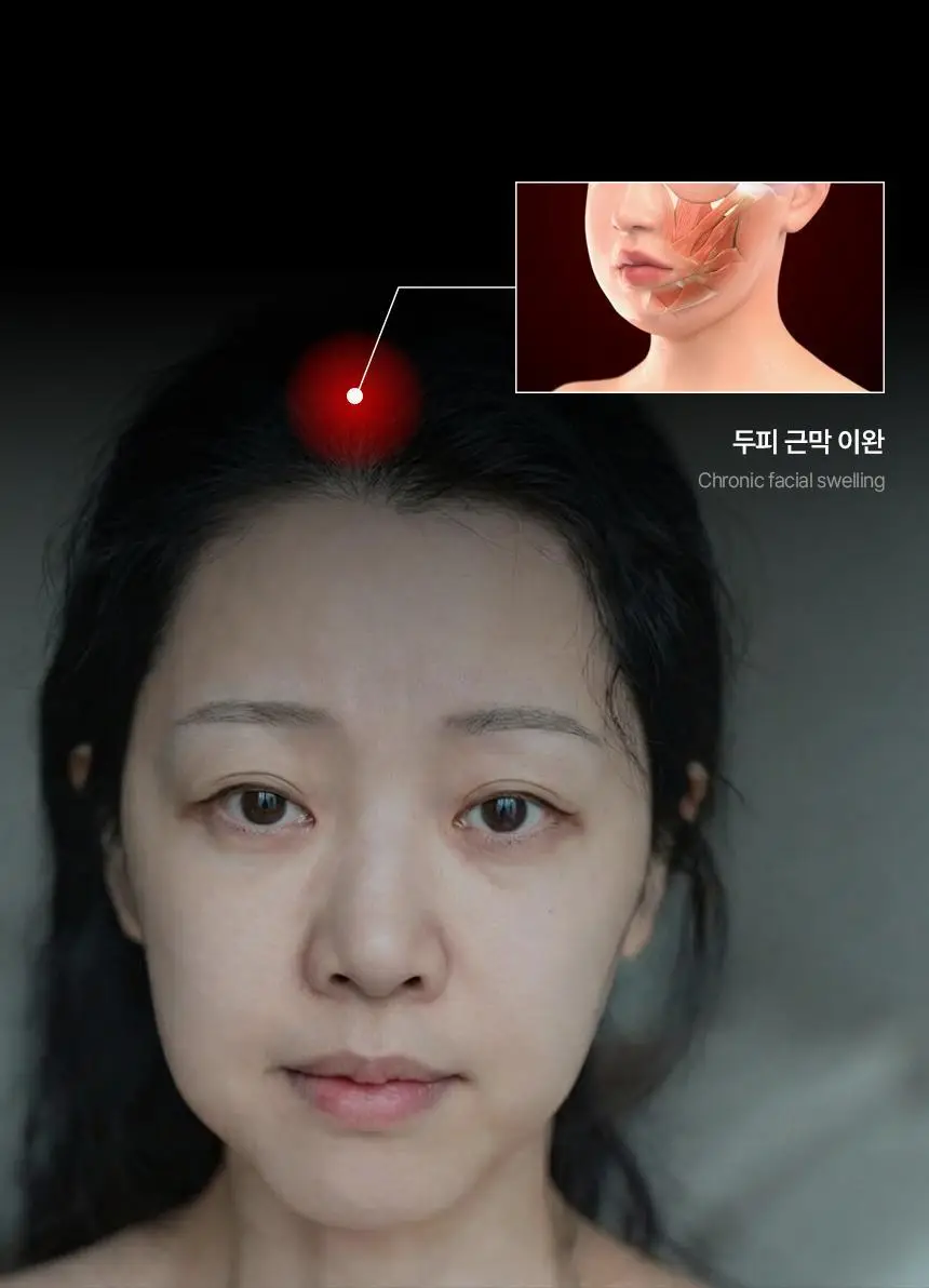 뷰앤디 리프트 헤드 스파 상세페이지 16