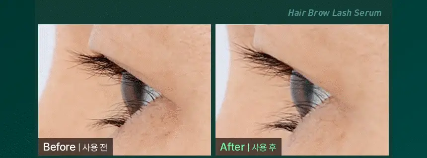 바이브랩 리바이브 테라피 헤어 브로우 래쉬 세럼 (헤어라인 겸용) 상세페이지 16